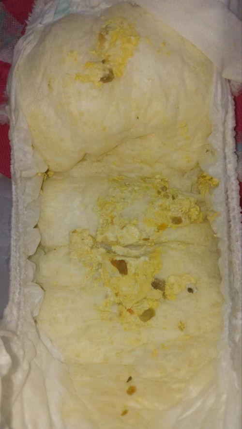 Poop/Pup/BAB anak usia 1 tahun