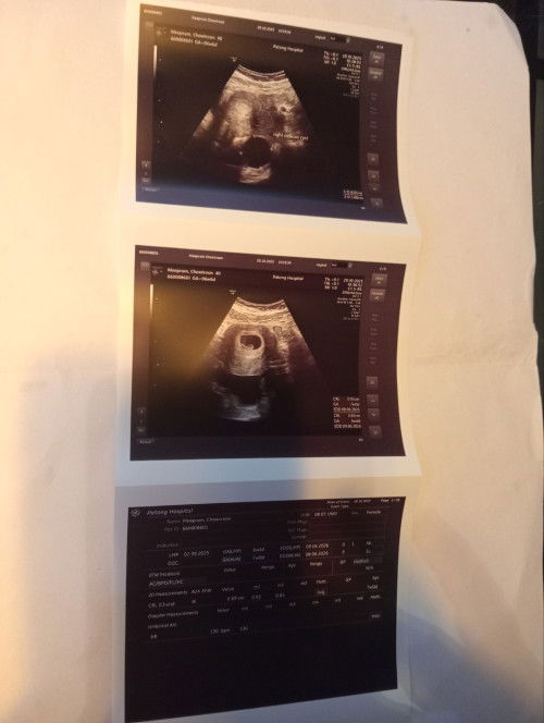 ตรวจครรภ์ครั้งแรกตอน6สัปดาห์ ยังไม่เห็นน้อง ได้ยินแต่เสียงหัวใจของน้องคะ ดีใจมากเลยคะ