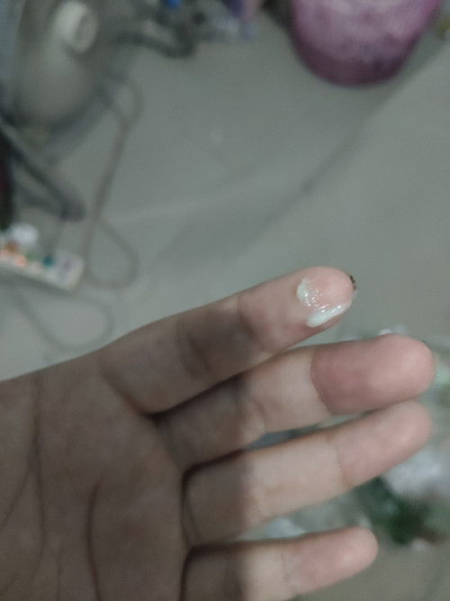 ท้อง33วีคมีก้อนอกมาแบบนี้คืออะไรคะ