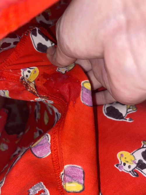 ตกขาวหรือนํ้าครํ่าไหลคะ