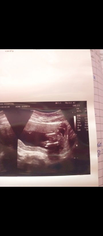 16+5วีคหญิงหรือชาย