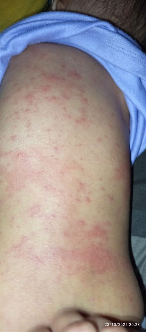 Saran produk buat biang keringet, sudah pakai apapun ga mempan, posisi saya ga pakai ac