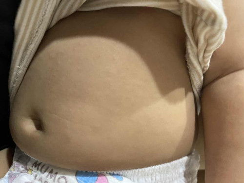 สอบถามค่ะแม่บ้านไหนน้องเป็นแบบนี้ไหมคะ