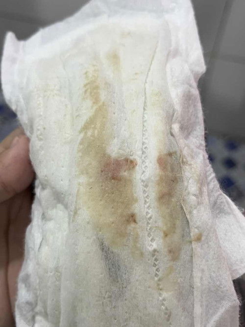 Semalem HB trs sekarang keluar lendir agak coklat dan sedikit darah normal ga ya bun?