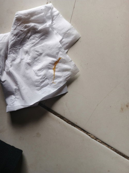 Flek bun dari yg warna coklat tua, ke coklat kuning