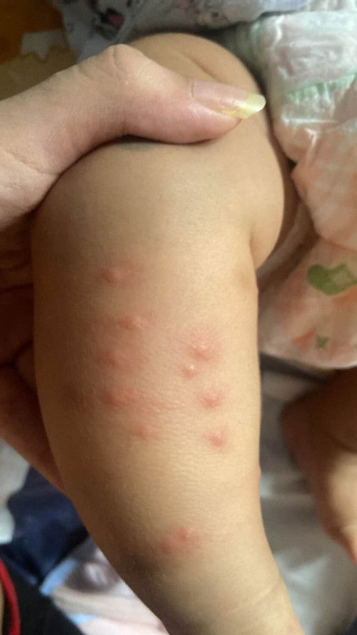 แม่ๆใช้อะไรดีคะ
