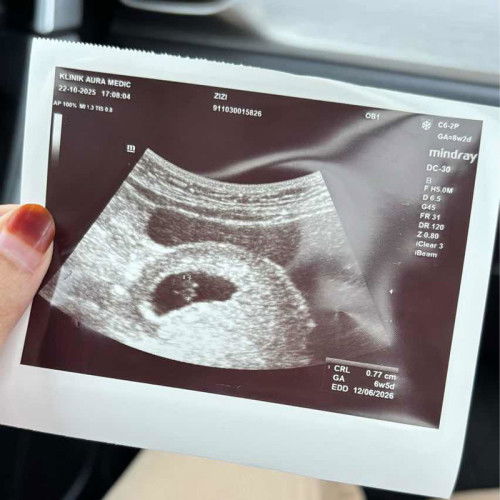 6w, no heartbeat detected