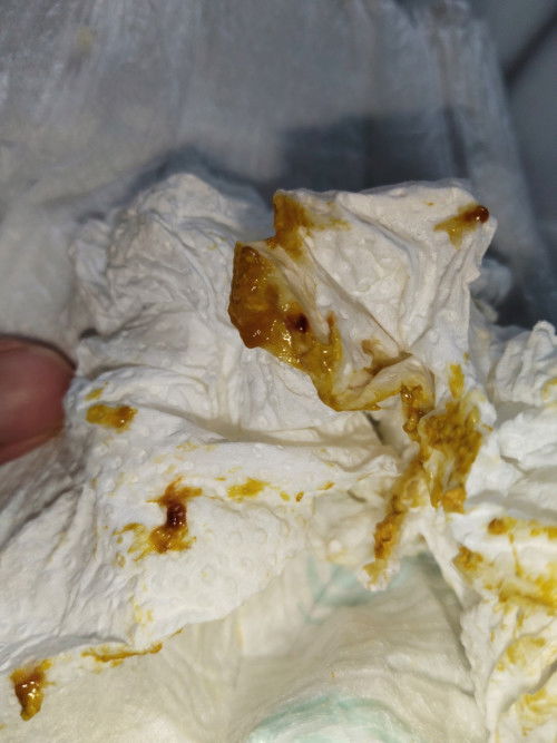 น้อง1เดือน 10วัน กินนมผง
ถ่ายมีเลือดนิดๆแบบนี้ เกิดจากอะไรค่ะ