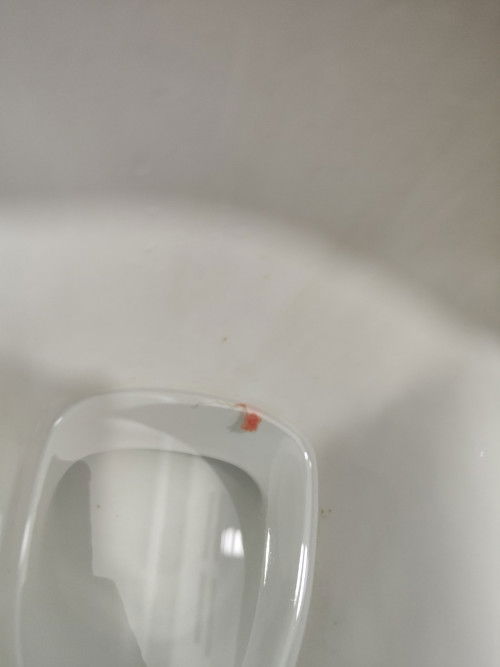 Kena pi hospital ke?