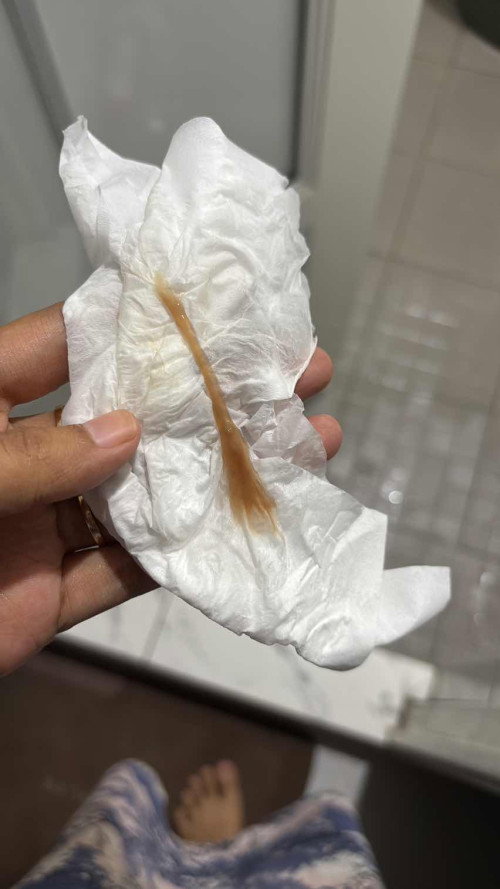 Darah keguguran alami tanpa kuret