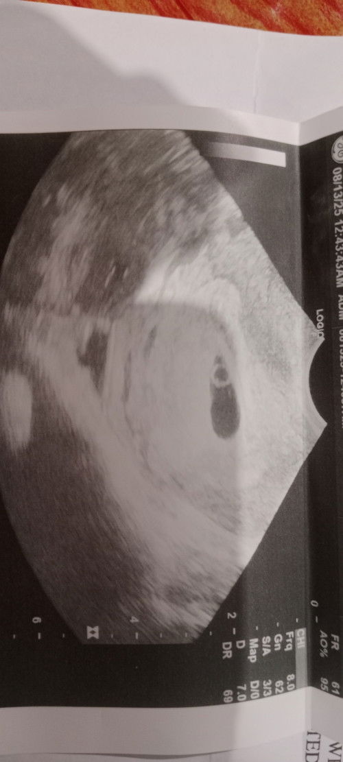 ᴍɢᴀ ᴍᴏᴍᴍɪᴇs ᴘᴏssɪʙʟᴇ ᴘᴏ ʙᴀ ɴᴀ ᴛᴡɪɴs ᴇᴛᴏ ᴍᴀsʏᴀᴅᴏ ᴘᴀ ᴋᴀsᴇ ᴍᴀᴀɢᴀ ᴇ 5 ᴡᴇᴇᴋs ᴀɴᴅ 1 ᴅᴀʏ ᴘᴀʟᴀɴɢ , ᴡᴀʟᴀ ᴋᴀsᴇ