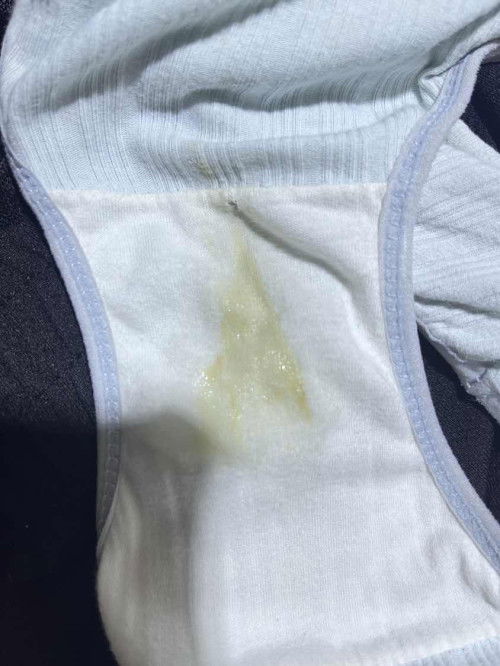 อายุครรภ์38+6