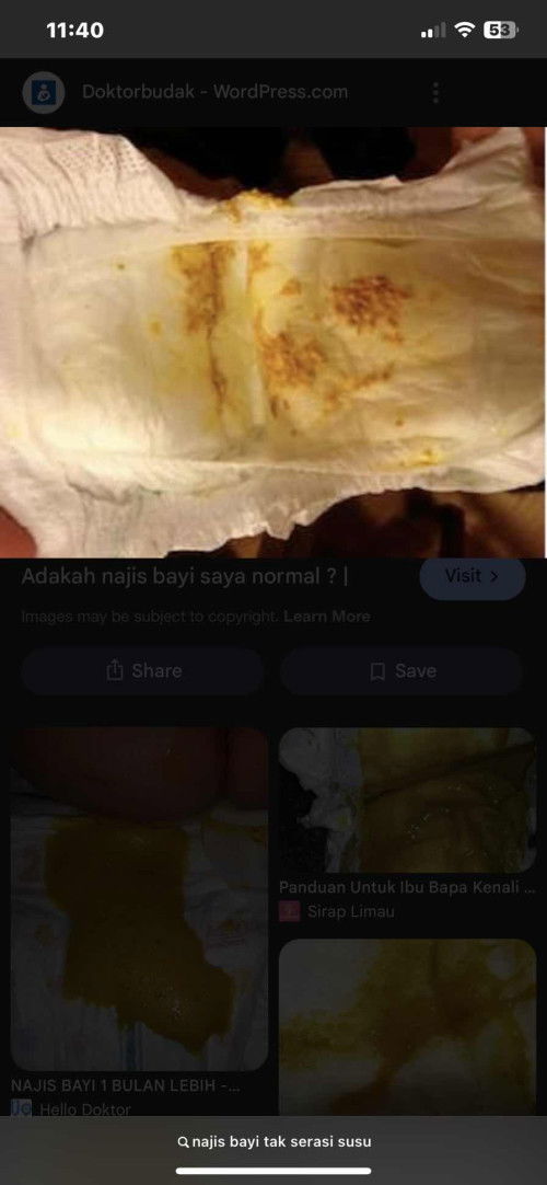 Anak nk masuk 2 tahun cirit lepas minum susu