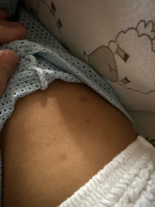 Red bumps (HELP)