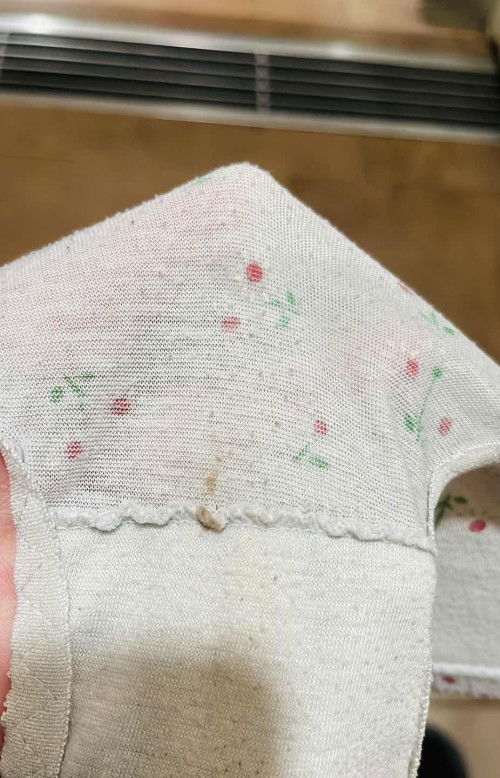 Spotting lepas balik dr scan