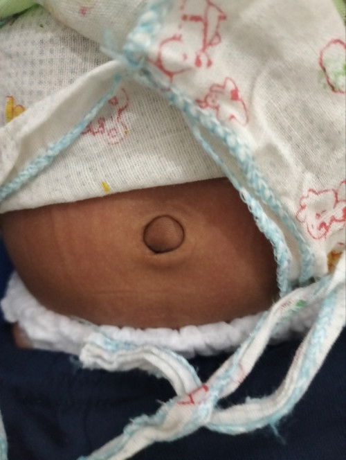 Pusar baby normalnya.