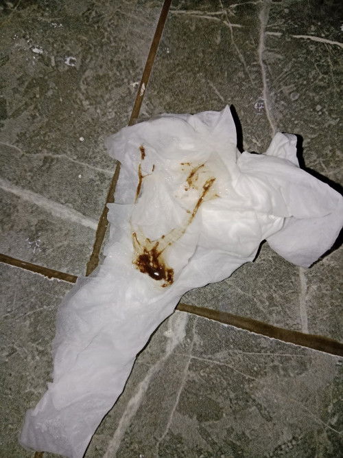 Flek Coklat 38 Week 5 Hari