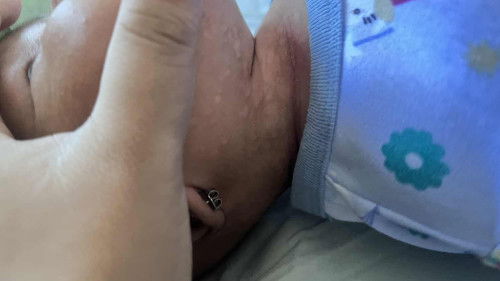 Bayi 1 bulaaan ada yg gini gak lehernya bu ibuu??