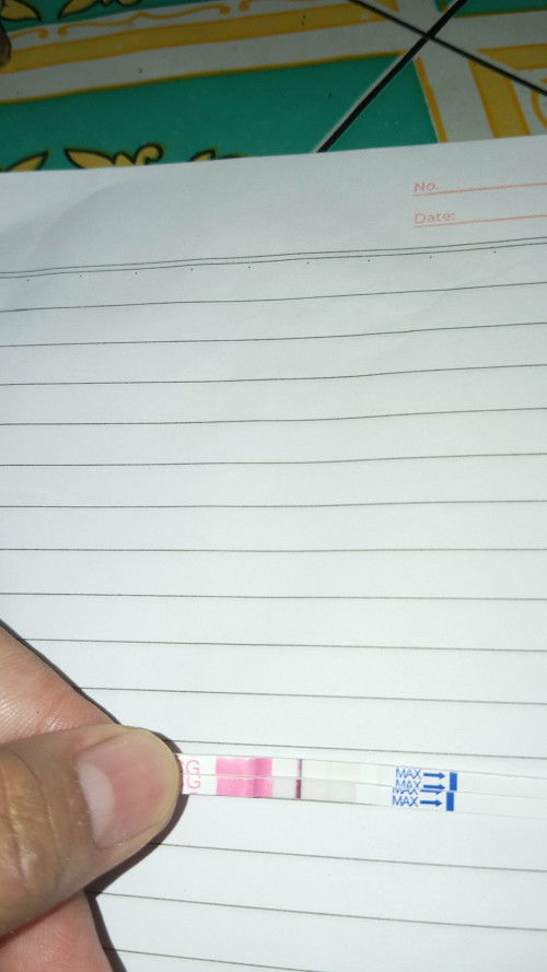 Apakah ini fix positif bun?