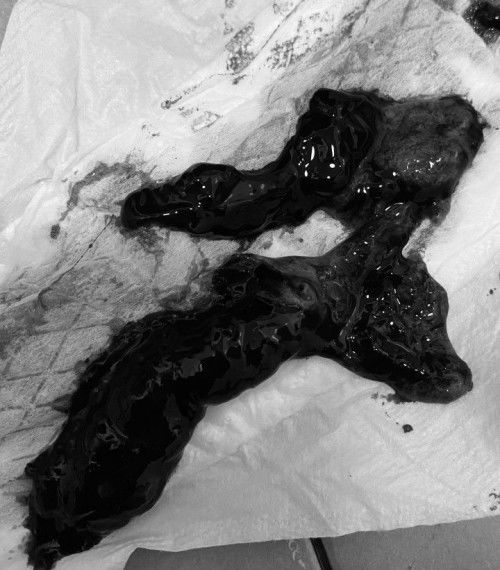 แบบนี้คือน้องไม่อยู่แล้วใช่ไหมคะ