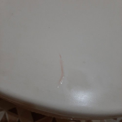 Mom,aku hamil 2 minggu lebih 3 hari tapi ada lendir bercampur darah ada yang tahu kenapa ya?