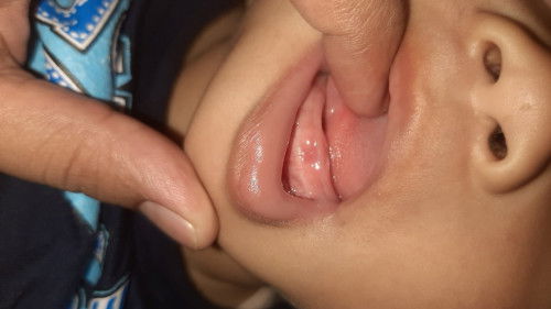 Bun ini gigi bukan ya