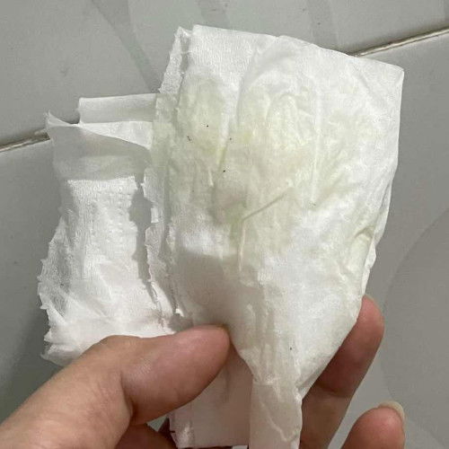 Bầu 12-13w ra dịch như hình thỉnh thoảng có ngứa có sao không ạ? 🥲 Bầu lần đầu hơi lo