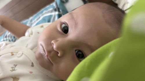 Mata merah bayi 6 bulan