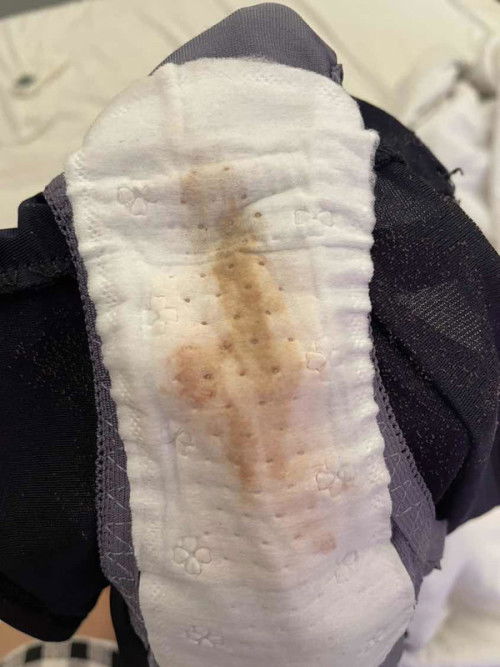 Spotting 9week pregnancy