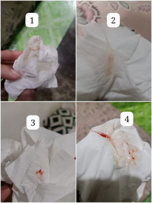 Bunda2 mf klo geli/jjik bs skip. Aku ngflek spt ini di kehmlan 6week ini. Dan msih ngflek tpi sdkit2