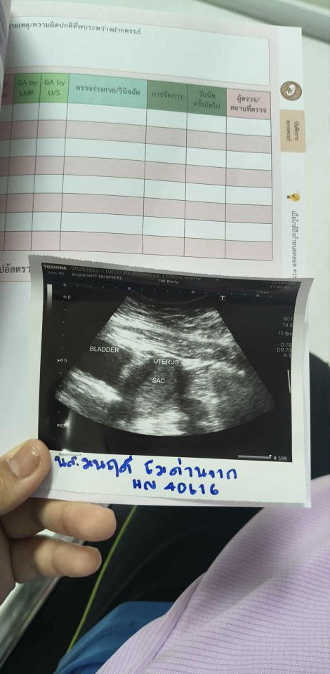 ขอกำลังหน่อยค่ะแม่ๆ