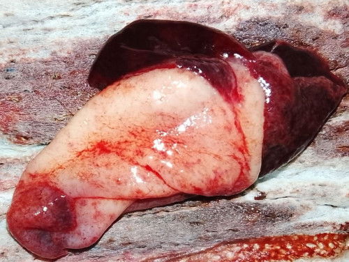 ลิ่มเลือดสีแดงออกมาพร้อมกับสีขาวใช่การแท้งไหมค่ะหรือประจำเดือนผิดปกติ🥹