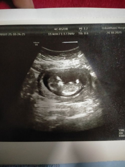 13สัปดาห์++