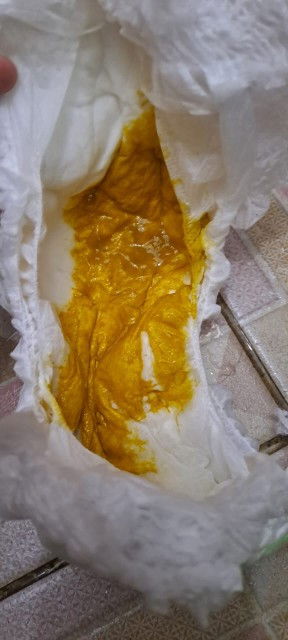 Bayiku 5 bulan bab nya seperti ini tidak seperti biasanya , apakah normal bun?