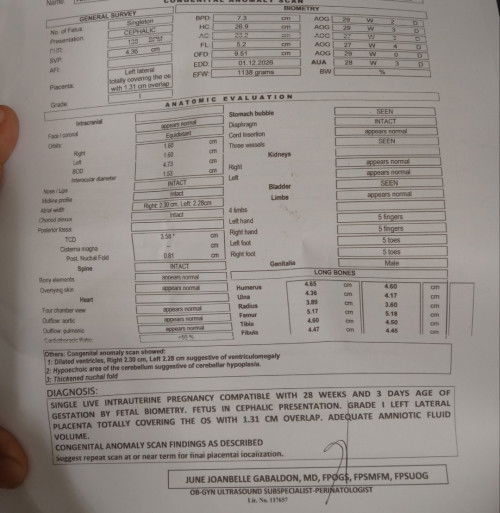 May case po ba dito ng katulad sa baby ko? Kamusta ang baby niyo?