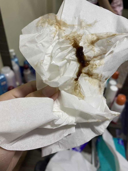 อายุครรภ์ 39 week เป็นแบบนี้ต้องไปหาหมอไหมคะ