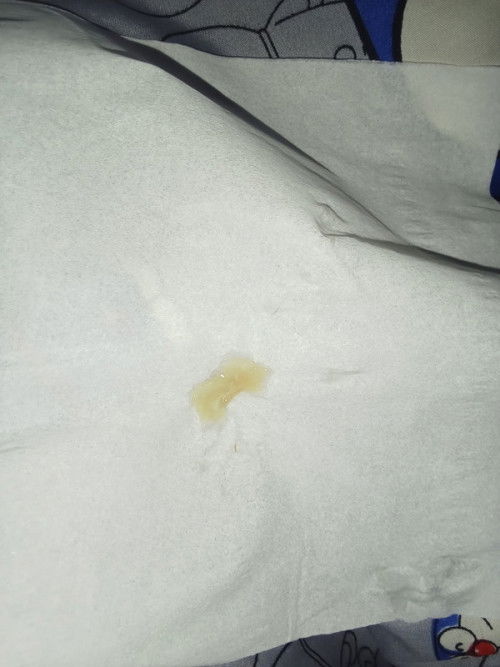 สอบถามแม่ๆ และผู้มีประสบการณ์