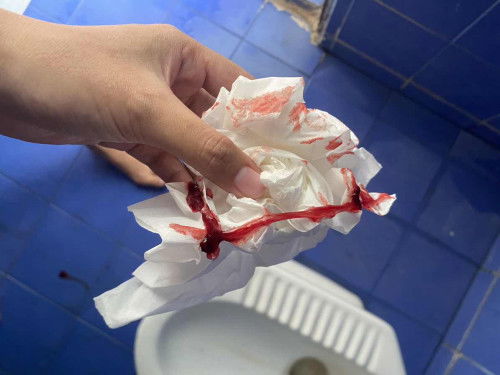 สอบถามเเม่ๆ