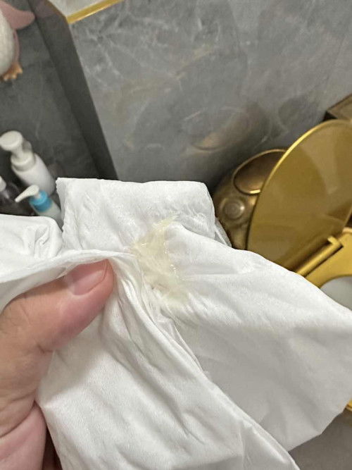 มีมูกใสออกมาแบบนี้34+5 สัปดา ไม่มีอากานอื่น จะเป็นไรไหมคะแม่ๆ