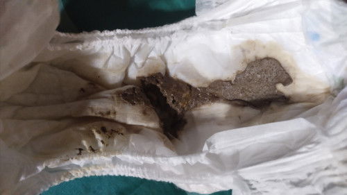 Pup bayi 6bulan 12hari