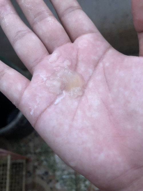 37+5วีคมีมูกไหลออกแบบนี้ทุกครั้งที่เข้าห้องน้ำมีอาการปวดท้องคล้ายประจำเดือนนิดหน่อยไม่มีเลือดหรือท้องปั้นแบบนี้เรียกว่าอะไรหรอคะแม่ๆ