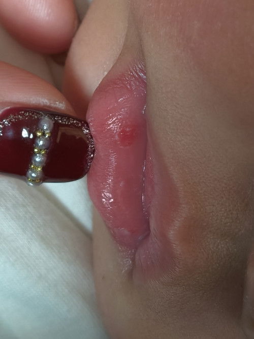 ปากเป็นร้อนใน แผลในปาก