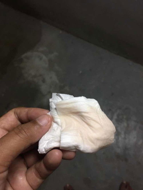 37วีค5วัน ต้องนีบไปรพไหม หรือให้อาการปวดถี่กว่านี้