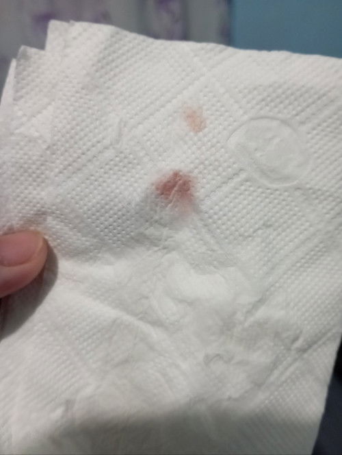 bakit po kaya may dugo