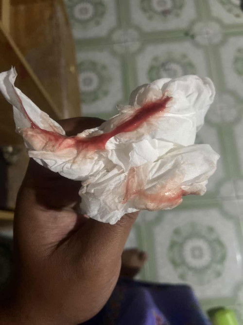 หลังโดนกระตุ้นปากมดลูก