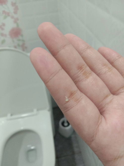 ครรภ์แรก ตอนนี้ 36 วีค 4 วัน