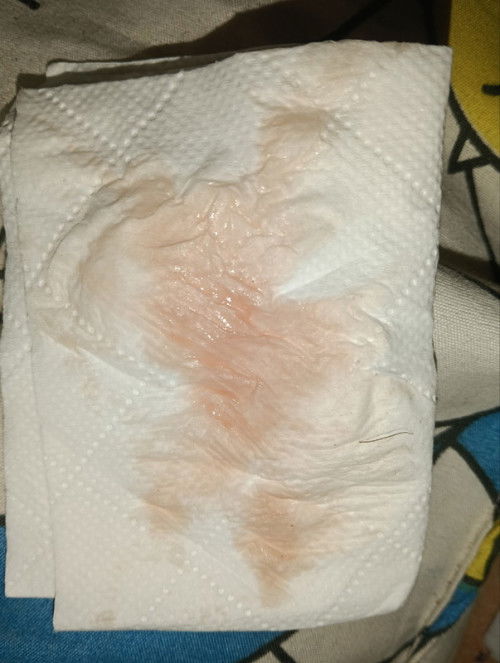 ท้อง2เมือกใส เป็นแบบนี้ คืออะไรค่ะ