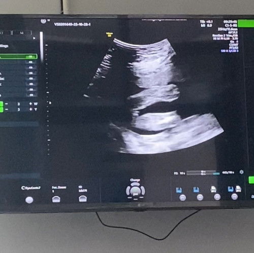 แบบนี้สาวน้อยไหมคะแม่ๆ