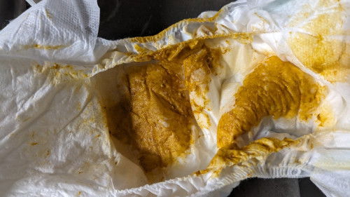 Mau tanya bun, pup bayi seperti ini normal atau diare ya? Bayiku baru 1 bulan, ASI aja