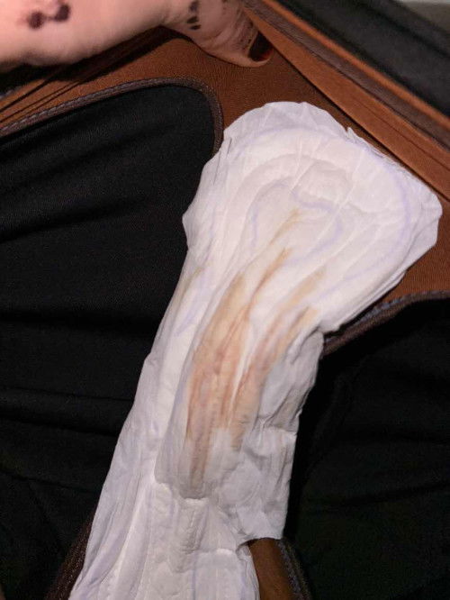 Normal ke kalau kluar spotting mcm ni ?